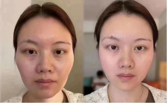 哪个牌子好这款重现青春光彩凯发K8旗舰厅抗皱纹抗衰老(图1)