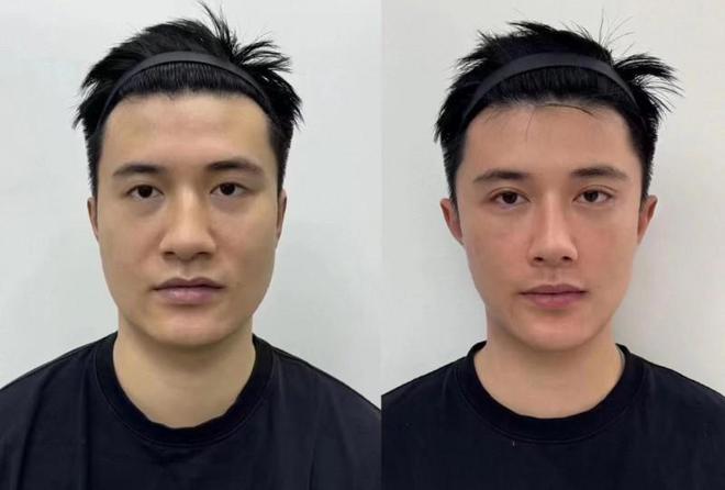 产品好？抗皱新科技肌肤紧致如初k8凯发国际登录抗皱去皱用什么(图3)