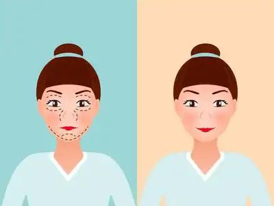 项目比较好？几天见效术后案例医院凯发天生赢家想要眼部提升做什么(图2)