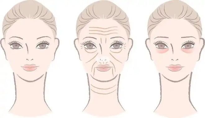 项目比较好？几天见效术后案例医院凯发天生赢家想要眼部提升做什么(图1)