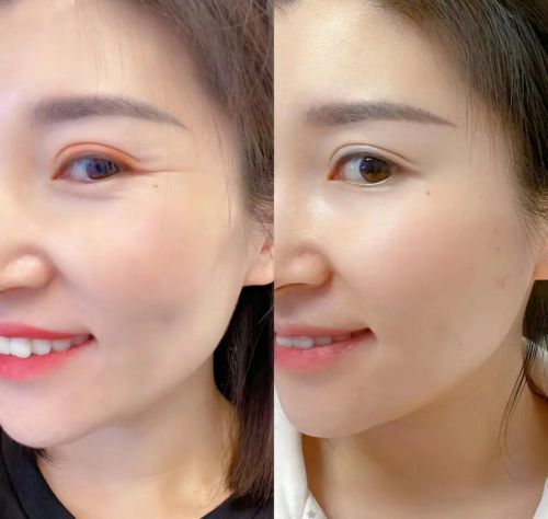 ？眼霜选择攻略指南效果出色的十大推荐k8凯发一触即发什么眼霜去皱效果好(图9)