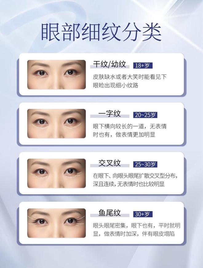 比较好？十强眼霜排行榜单去皱公认好用的凯发K8旗舰厅AG客服去皱眼霜哪个牌子(图10)